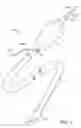 Fig. 02 - Facilitated balloon catheter exchange