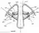 Fig. 19 - Nasal cavity dilator