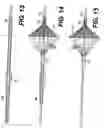 Fig. 08 - Embolic protection device