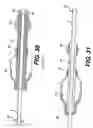 Fig. 13 - Embolic protection device