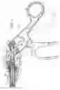 Fig. 04 - Articulating endoscopic surgical apparatus