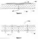 Fig. 04 - Methods and devices for anchoring to soft tissue