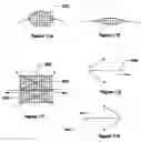 Fig. 15 - Methods and devices for anchoring to soft tissue