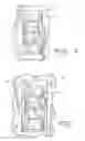 Fig. 04 - Surgical method and composition utilizing submucosal tissue to prevent incisional hernias
