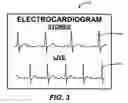 Fig. 04 - System and method for presenting defibrillator status information while in standby mode