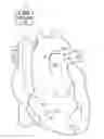 Fig. 01 - System with left/right pulmonary artery electrodes