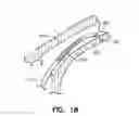 Fig. 12 - System with left/right pulmonary artery electrodes