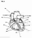 Fig. 03 - Apparatus and method for optimizing atrioventricular delay