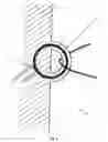 Fig. 02 - Transcutaneous power and/or data tranceiver system