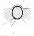 Fig. 04 - Transcutaneous power and/or data tranceiver system