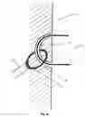 Fig. 11 - Transcutaneous power and/or data tranceiver system