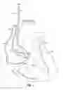 Fig. 02 - Lead and catheter assembly