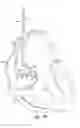 Fig. 05 - Lead and catheter assembly