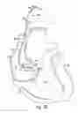 Fig. 10 - Lead and catheter assembly