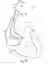 Fig. 14 - Lead and catheter assembly