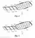 Fig. 05 - Flexible circuit electrode array