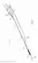 Fig. 02 - Apparatus and methods for delivering prostheses to luminal bifurcations