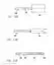 Fig. 09 - Expandable and retrievable stent