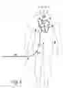Fig. 02 - Device for inserting an object into the interior of a blood vessel or the heart