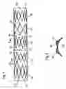 Fig. 02 - Lining for bodily lumen