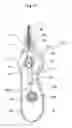 Fig. 51 - Stent delivery device