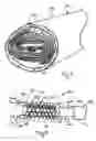 Fig. 07 - System and method for forming composite stent-graft assembly in-situ