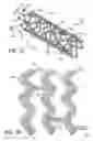 Fig. 02 - Medical devices and methods of making the same