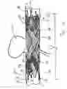Fig. 02 - Medical devices including metallic films