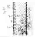 Fig. 19 - Medical devices including metallic films