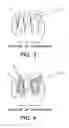 Fig. 03 - Elastomerically impregnated ePTFE to enhance stretch and recovery properties for vascular grafts and coverings