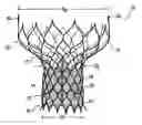 Application 20060259136, fig. 01