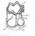 Application 20060259137, fig. 01