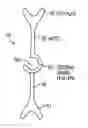 Fig. 01 - Intraocular lens for correcting presbyopia