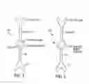 Fig. 02 - Intraocular lens for correcting presbyopia