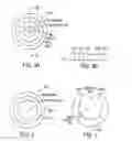 Fig. 03 - Intraocular lens for correcting presbyopia