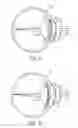 Fig. 05 - Intraocular lens for correcting presbyopia