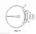 Fig. 06 - Intraocular lens for correcting presbyopia