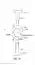 Fig. 09 - Intraocular lens for correcting presbyopia