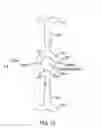 Fig. 10 - Intraocular lens for correcting presbyopia