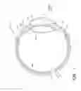 Fig. 02 - Accommodating intraocular lens system