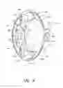 Fig. 06 - Accommodating intraocular lens system