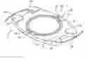 Fig. 01 - Floating optic accommodating intraocular lens