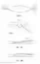 Fig. 04 - Floating optic accommodating intraocular lens
