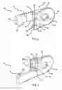 Fig. 03 - Pectus bar stabilizer