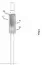 Fig. 04 - Pectus bar stabilizer