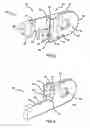 Fig. 07 - Pectus bar stabilizer