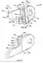 Fig. 13 - Pectus bar stabilizer