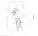 Fig. 09 - Prosthetic facet joint ligament