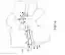 Fig. 12 - Prosthetic facet joint ligament