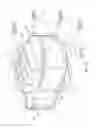 Fig. 18 - Artificial disc prosthesis